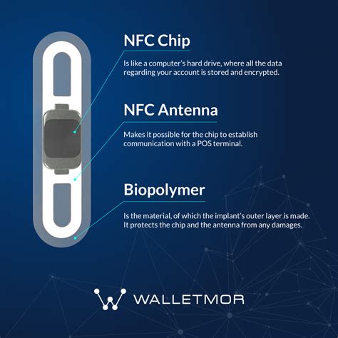 rfid nfc chip implant|The microchip implants that let you pay with your .